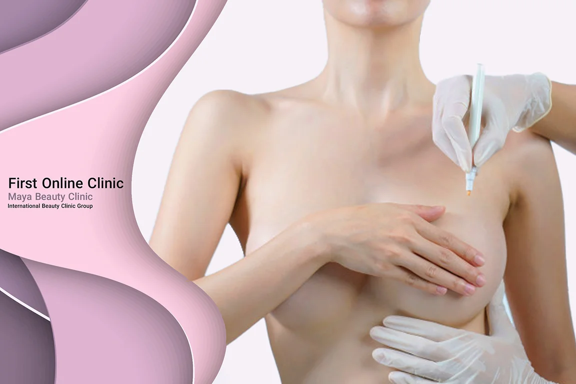 Breast prosthesis