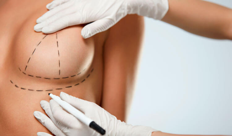 Benefits and disadvantages of breast lift